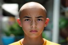 16岁男孩秃头了：挑战青春，我们一起见证成长记忆