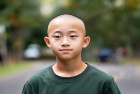 16岁男孩秃头了，我们一起挑战青春困境