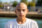 16岁男孩秃头了：青春秃头故事，自我蜕变成长记