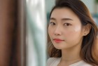 整鼻7次鼻梁成C形，美丽蜕变记——梦想成真，惊喜不断